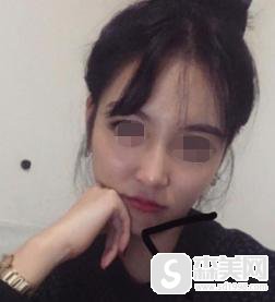 南医大二附院整形美容怎么样?口碑介绍+医生简介+隆鼻案例分享!