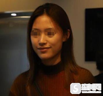 北京市中西医结合医院整形美容科如何？内含口碑简介+相关案例展示！