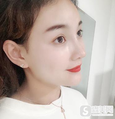 北京京都时尚整形情况咋样?整形案例介绍-医生专业能力