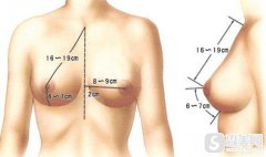 没问题隆胸术是什么？果怎么样？附隆胸案例分享＋隆胸果前后对比图