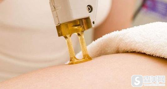 北京激光脱毛费用是多少附激光脱毛案例+脱毛前后果对比图