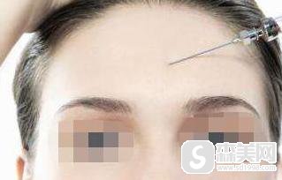 额头凹陷填充术多少钱?果怎么样?附额头凹陷填充手术案例分享