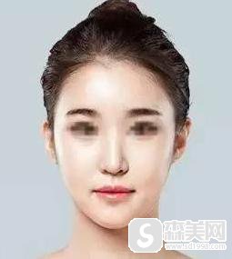 光纤溶脂原理是什么？价格是多少？附光纤溶脂案例前后果对比图