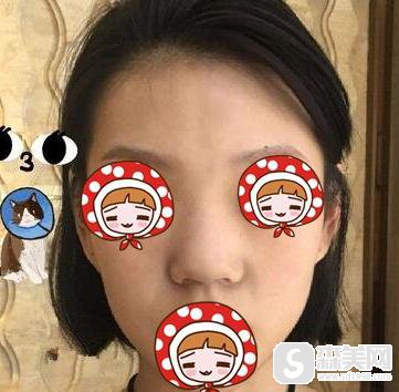 青岛诺德整形医院有什么服务-医生技术-隆鼻术后真实吗