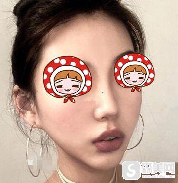 青岛诺德整形医院有什么服务-医生技术-隆鼻术后真实吗