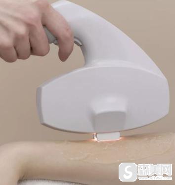 腋下脱毛多少钱?激光脱毛果怎么样?附激光脱毛前后果对比图