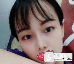 玻尿酸隆鼻价位怎么样?果怎么样?附玻尿酸隆鼻前后对比照