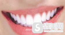 冷光美白牙齿多少钱？果怎么样？附牙齿冷光美白前后果对比图