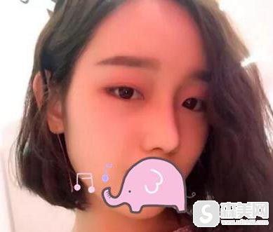 整形医生郜杰个人简介？昊阳郜杰医疗美容诊所/医生口碑情况/案例分享