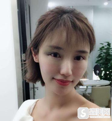 江门华美医院2021价格表脂肪填充怎么样?附填充项目较新价格表