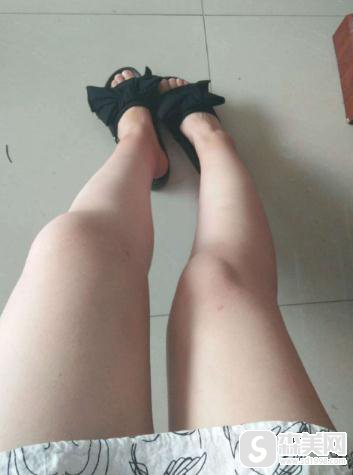 河南省人民医院整形科价格表,附大腿吸脂手术前后果对比图?