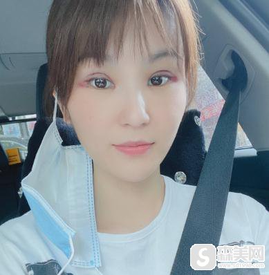 艺星医学美容医院价目表2021，整形医院哪家好？内含双眼皮手术案例