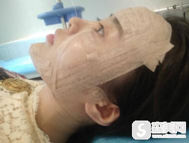 塘沽长征医院整形科价目表2020，填充价格，内含面部填充手术果图