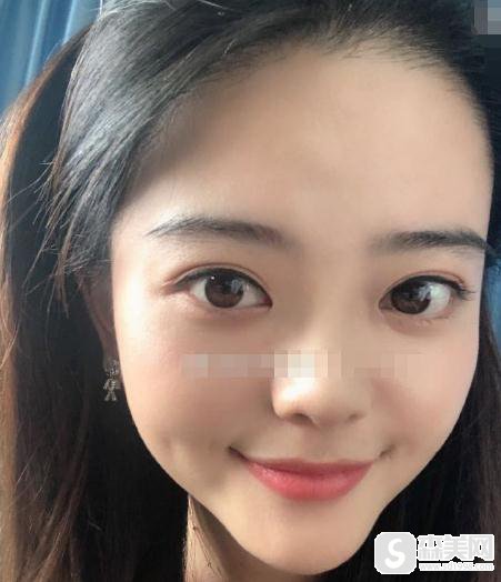 北京博士园植发医院价目表2021,植发价格,内含植发案例对比照片