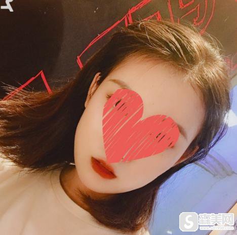 注射瘦脸的价格是多少?附注射瘦脸案例分享+案例前后对比图