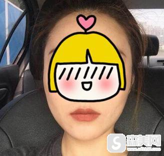 镭射溶脂价格?镭射溶脂果怎么样?镭射溶脂案例前后果对比图