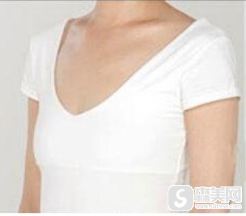 碧波庭丰胸多少钱？附碧波庭整形案例分享+碧波庭隆胸真人案例
