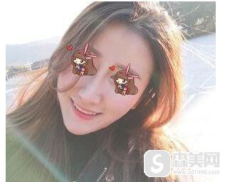 叶信海医生怎么样？附上海第十人民医院整形科介绍及叶信海医师隆鼻成功案例