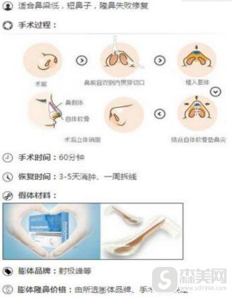 膨体隆鼻的价格?附膨体隆鼻案例+术前术后果对比图