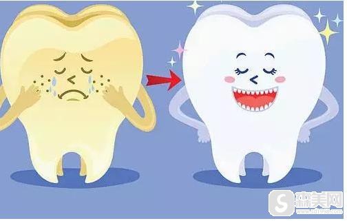 超声波洗牙多少钱?附超声波洗牙相关介绍及真实案例分享