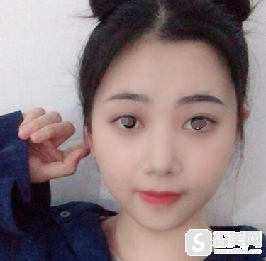 北京八大处美容整形价目表2021，内含卢建建下角额整形案例分享