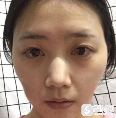 北京八大处美容整形价目表2021，内含卢建建下角额整形案例分享