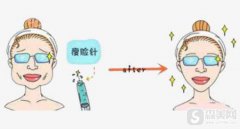 注射注射瘦脸多少钱？附注射瘦脸案例+前后果对比图