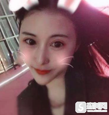 西安高一生医疗美容医院价格表2020隆鼻怎样，内含鼻翼缩小术果图