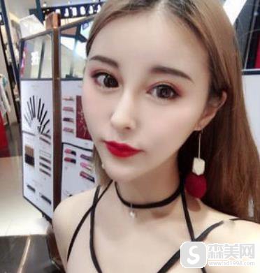 西安高一生医疗美容医院价格表2020隆鼻怎样，内含鼻翼缩小术果图