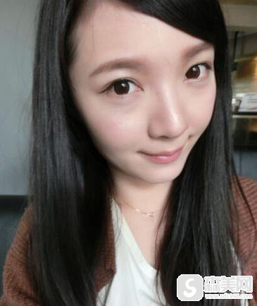 汉中仁爱整形医院价目表2021,填充手术怎么样?内含玻尿酸丰泪沟案例