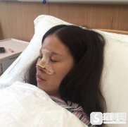 成都铜雀台整形医院价格表2020，鼻翼缩小术价钱，内附鼻翼缩小术果图
