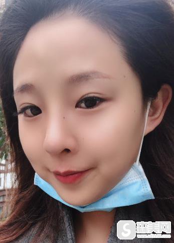 上海九院价目表2020,常雷整形医生隆鼻价格怎么样?内含隆鼻案例