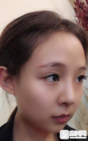 上海九院价目表2020,常雷整形医生隆鼻价格怎么样?内含隆鼻案例