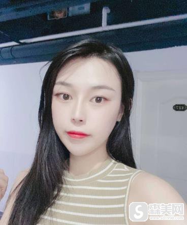 第四军医大学唐都医院价目表2021,内含陈辉整形医生假体隆鼻案例果前后对比图