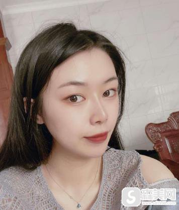 第四军医大学唐都医院价目表2021,内含陈辉整形医生假体隆鼻案例果前后对比图