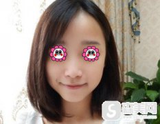 玻尿酸丰唇对比好不好?/注射玻尿酸丰唇后有什么果/玻尿酸丰唇的价格