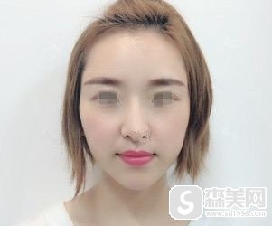 玻尿酸医生资质是怎么样的/玻尿酸注射案例分享/玻尿酸注射价目表