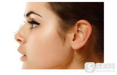 驼峰鼻整形要多少钱？驼峰鼻整形果怎么样？附驼峰鼻介绍级案例分享
