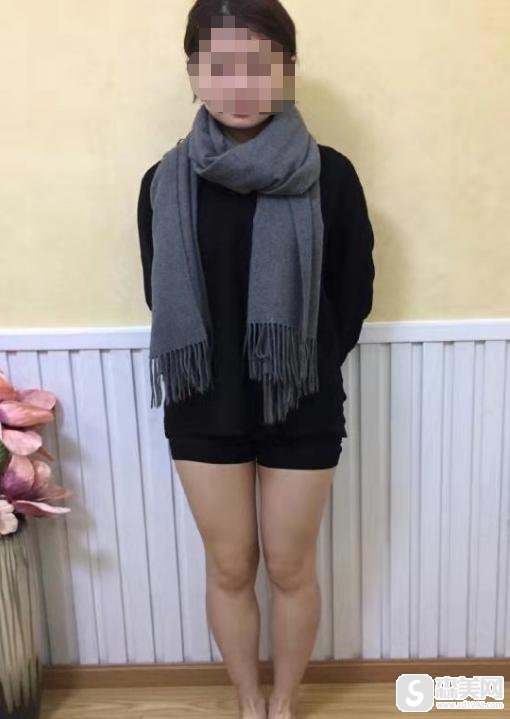 光纤溶脂要多少钱？光纤溶脂的果好不好？附光纤溶脂介绍及案例分享