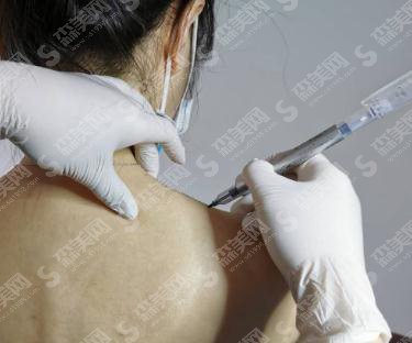 清远市人民医院整形美容科价格表2021,瘦肩怎么样?附注射瘦肩项目较新价目表