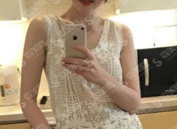 清远市人民医院整形美容科价格表2021,瘦肩怎么样?附注射瘦肩项目较新价目表