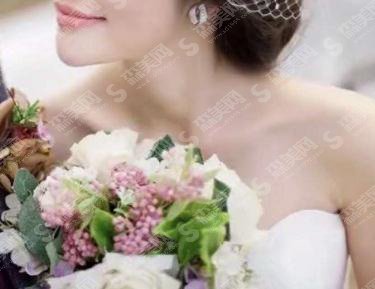 清远市人民医院整形美容科价格表2021,瘦肩怎么样?附注射瘦肩项目较新价目表