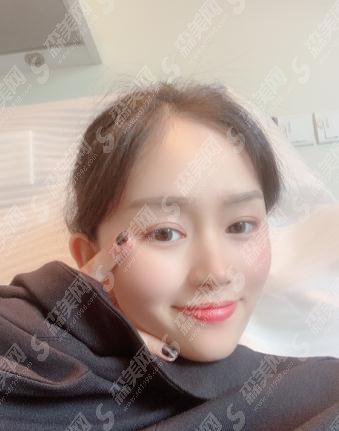 汕头大学医学院第一附属医院整形美容外科价格表2020,内含面部吸脂真人案例果图