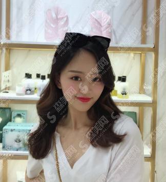 汕头大学医学院第一附属医院整形美容外科价格表2020,内含面部吸脂真人案例果图