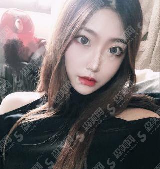 上海和睦家新城医院整形外科价目表2021,隆鼻价格,内含隆鼻真实案例