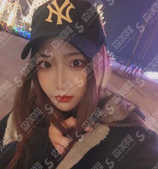 上海和睦家新城医院整形外科价目表2021,隆鼻价格,内含隆鼻真实案例