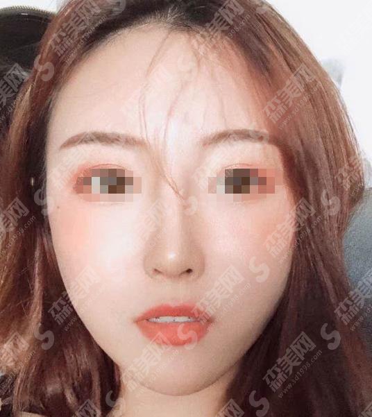 魏皎整形医生怎么样?附医院介绍&整形案例分享&上海九院专家