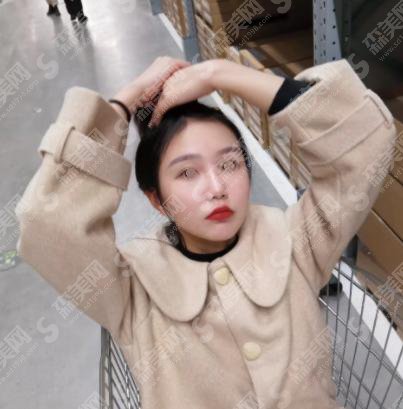 注射瘦脸多少钱？贵不贵？内附注射瘦脸案例+前后果对比图