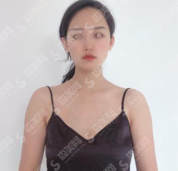 唐勇医生的介绍/成都八大处简介/唐勇医生案例分享/口碑详情