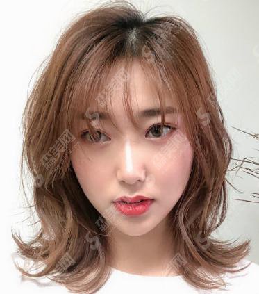 深圳市宝安区人民医院美容整形和烧伤科价目表2020,切开双眼皮案例前后果图